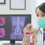 Colon cancer demonstration by a doctor with a mask on