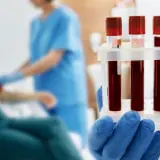 celiac disease testing